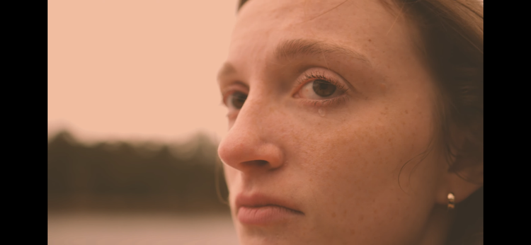 Freckle Study